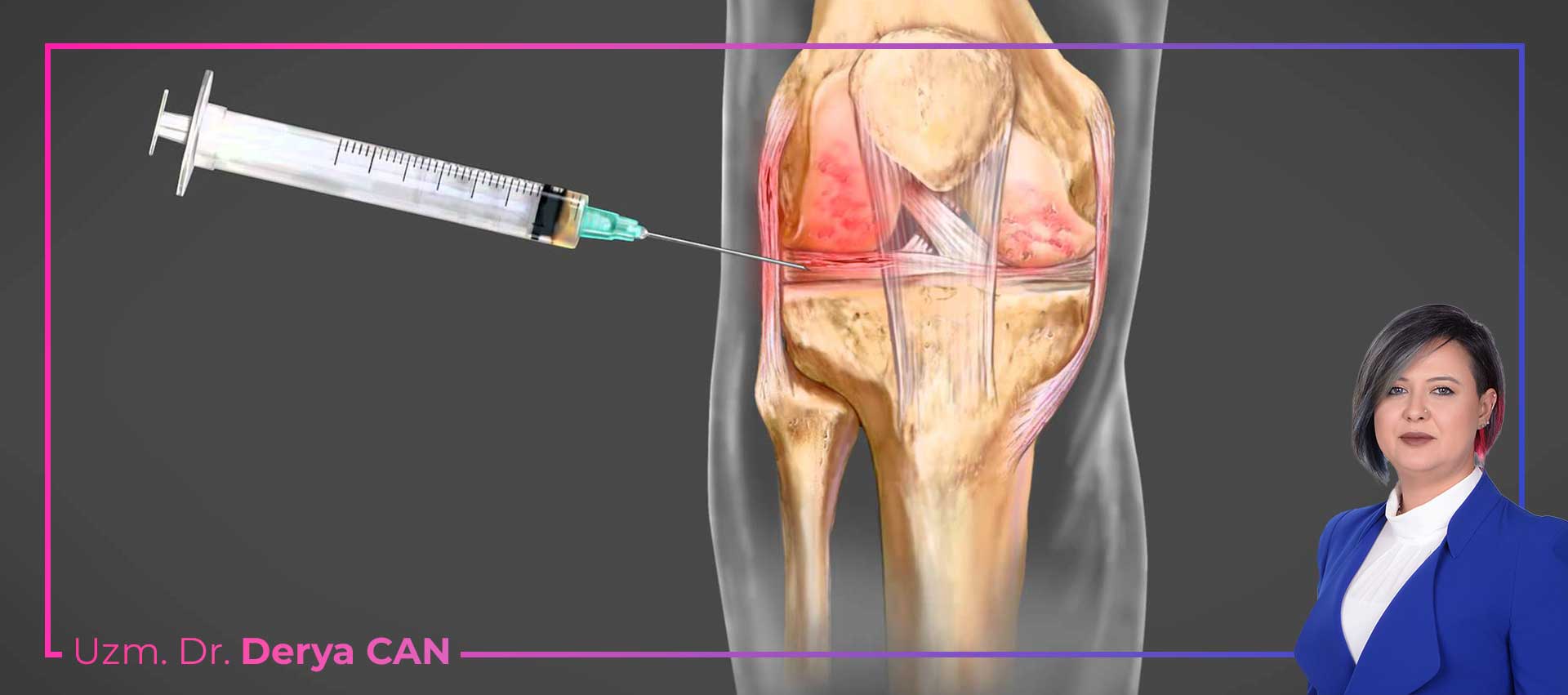 PRP tedavisinin faydaları nelerdir PRP tedavisi nedir PRP nasıl yapılır prp nedir