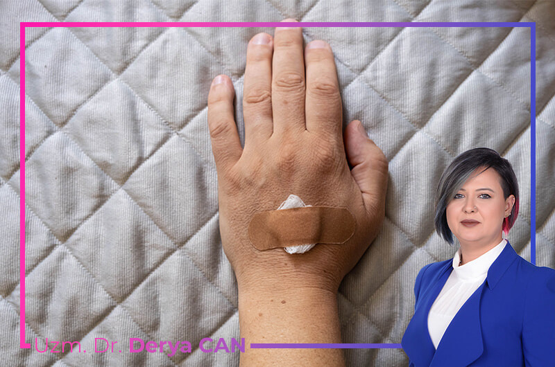 Ganglion kisti tedavisi nasıl yapılır - Dr. Derya Can