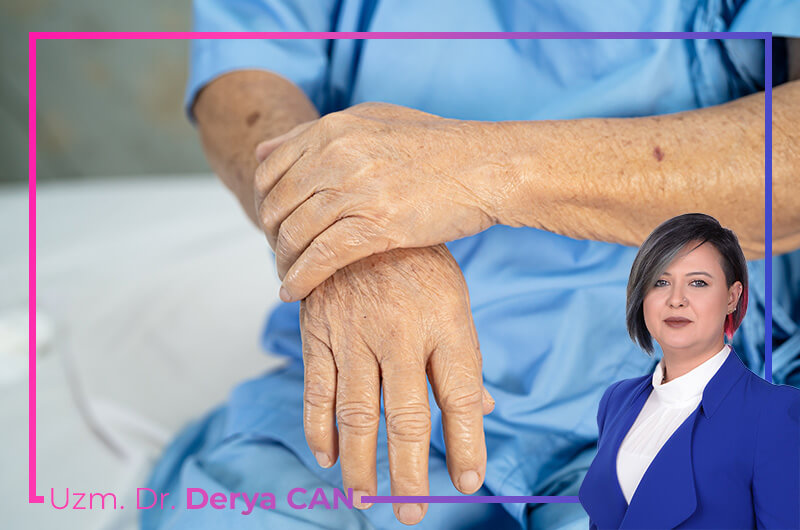 Kienböck Hastalığı Tedavisi 2 Kienböck hastalığı belirtileri nelerdir - Dr. Derya Can