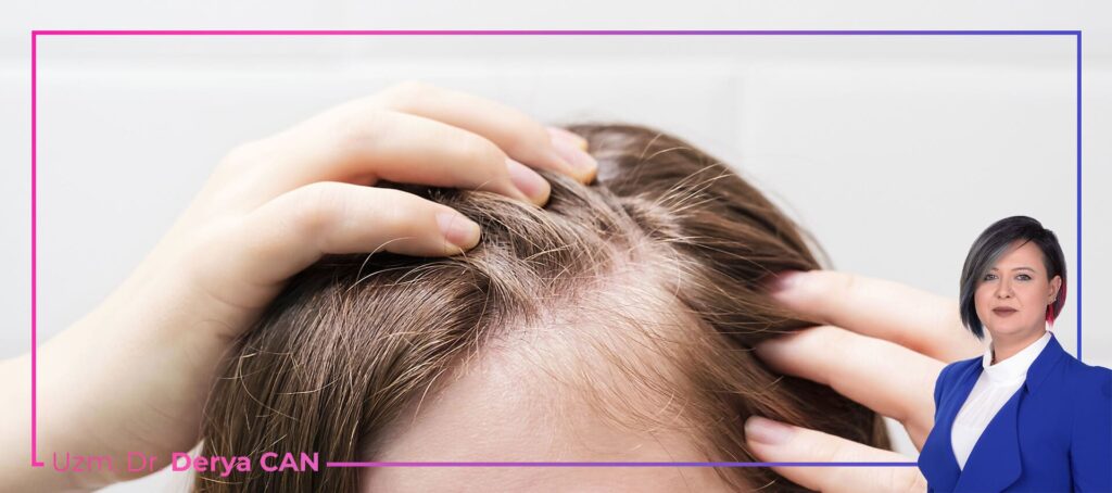 Kıl kökü zayıflığı nedir, belirtileri nelerdir