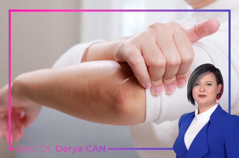 Tendinit ve Bursit sonucu oluşan eklem ağrıları görseli