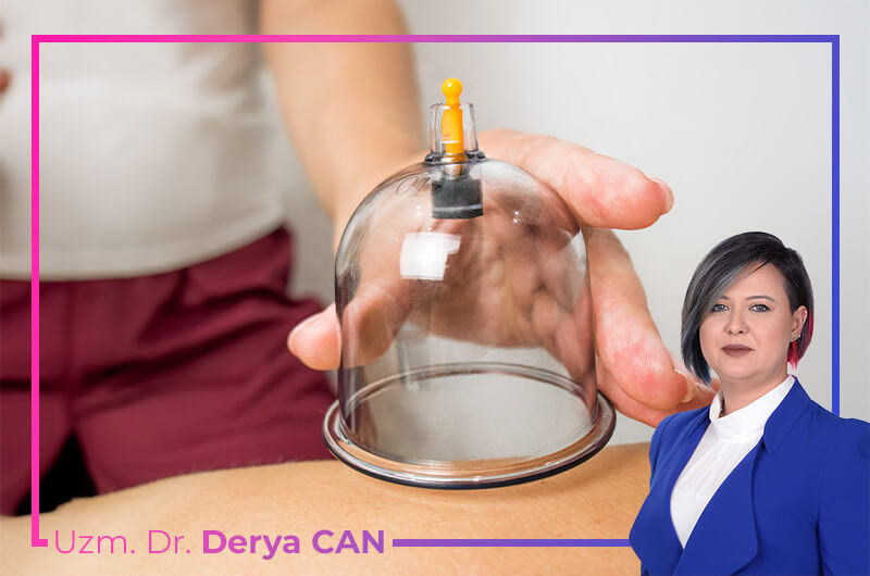 Hacamat Altın Günü Nedir? 16 Altın hacamat günü nedir?