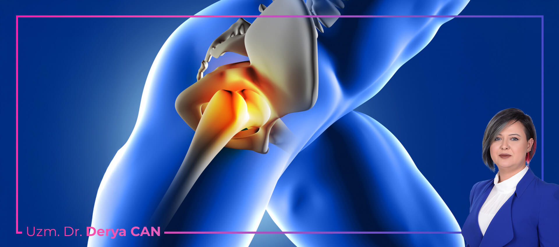 Avasküler Nekroz (Osteonekroz) Tedavisi 1 Avasküler Nekroz (Osteonekroz) Belirtileri Nelerdir