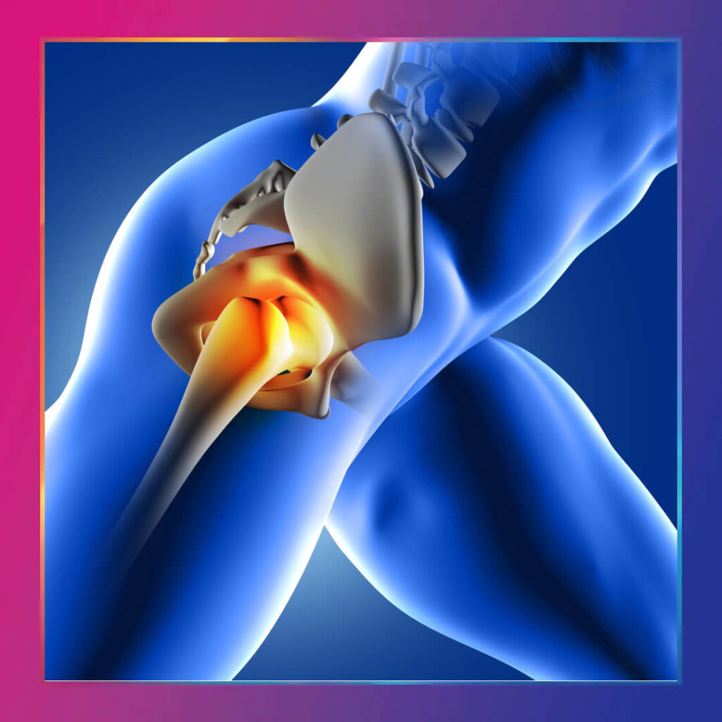 Avasküler Nekroz (Osteonekroz) Tedavisi Ankara