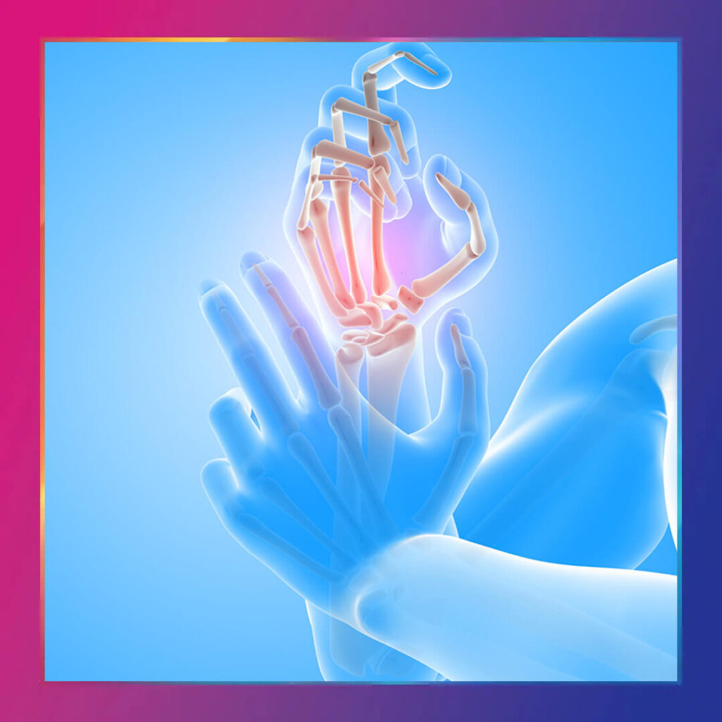 Bilekte artrit - Hastalıklar - Kapak