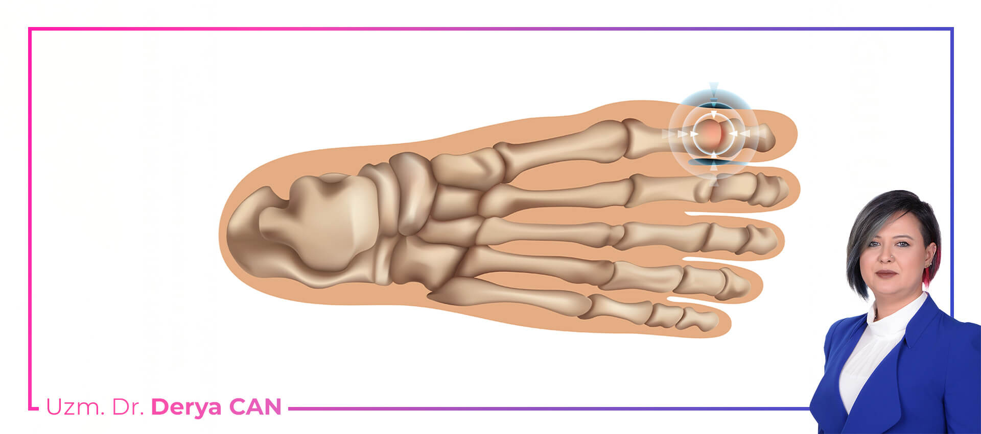 Freiberg hastalığı tedavi yöntemleri