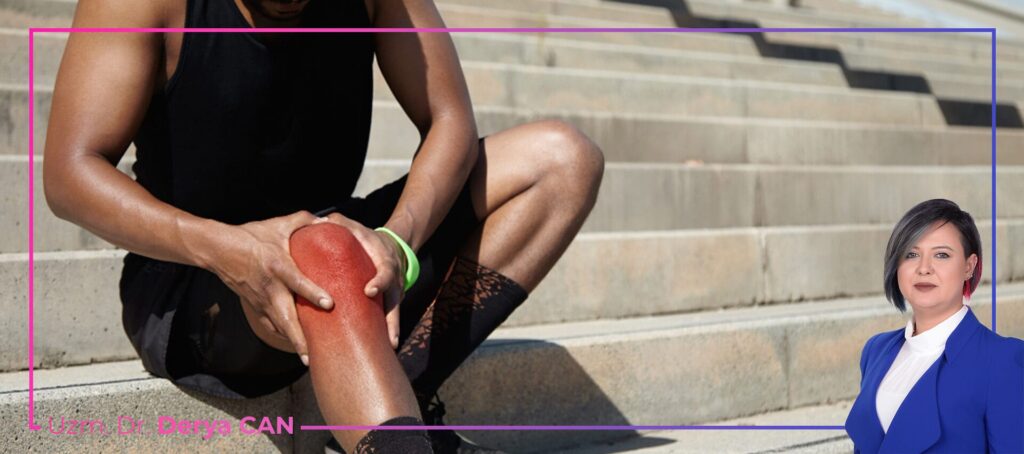 İliotibial bant sendromu nedir