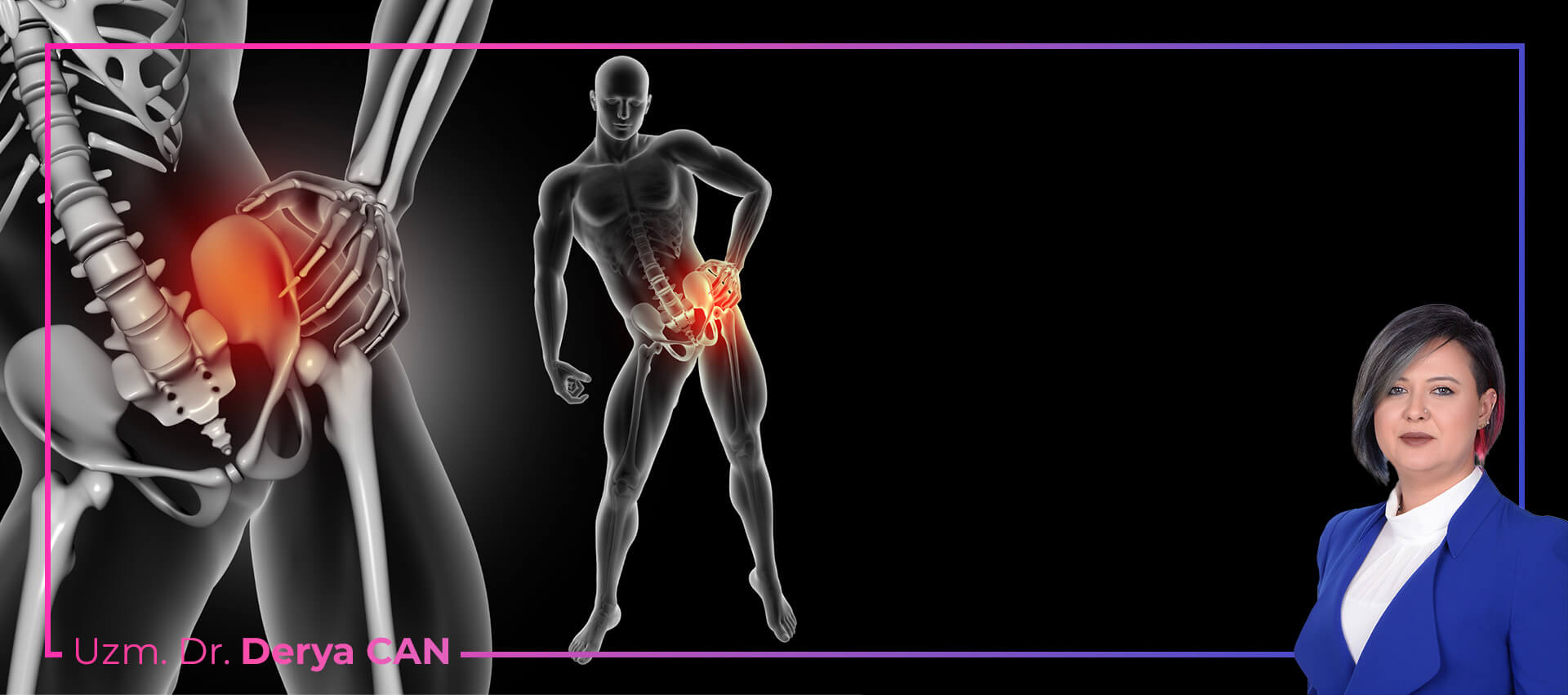 Kalça Kireçlenmesi (Koksartroz) Tedavisi 3 Kalça kireçlenmesi neden olur