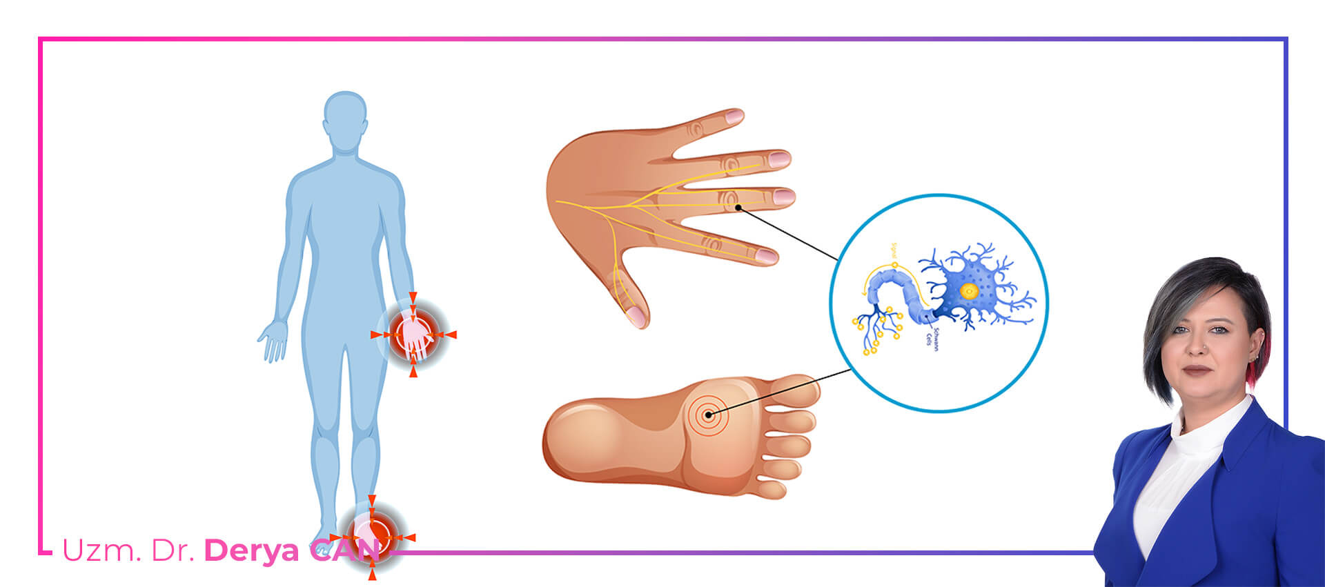 Nöropati Tedavisi 2 Dr Derya Can - Nöropati Nedir