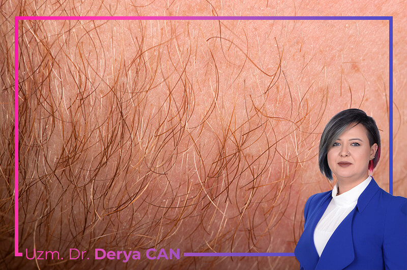 Sakal Mezoterapisi ve PRP Nedir? Aralarındaki Farklar Nelerdir? 7 Sakal Bölgesinde Uygulanan Destekleyici Yöntemler