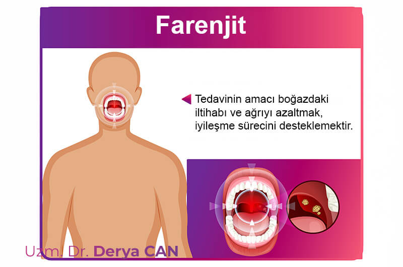 Farenjit Tedavisi 2 Farenjit tedavisinin amacı görseli