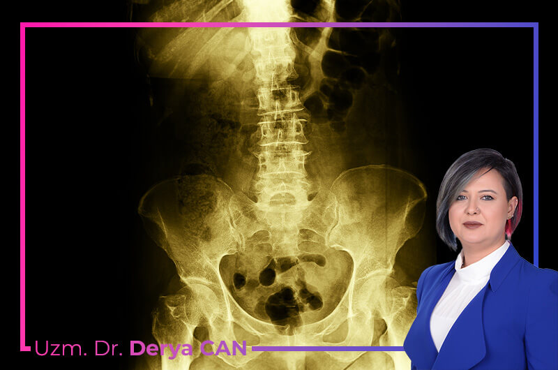 Spondilolizis Tedavisi 1 Dr Derya Can - Spondilolizis Tedavisi - Ankara