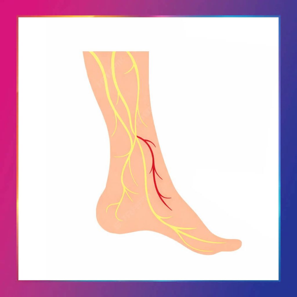 Diyabetik nöropati tedavisi kapak görseli