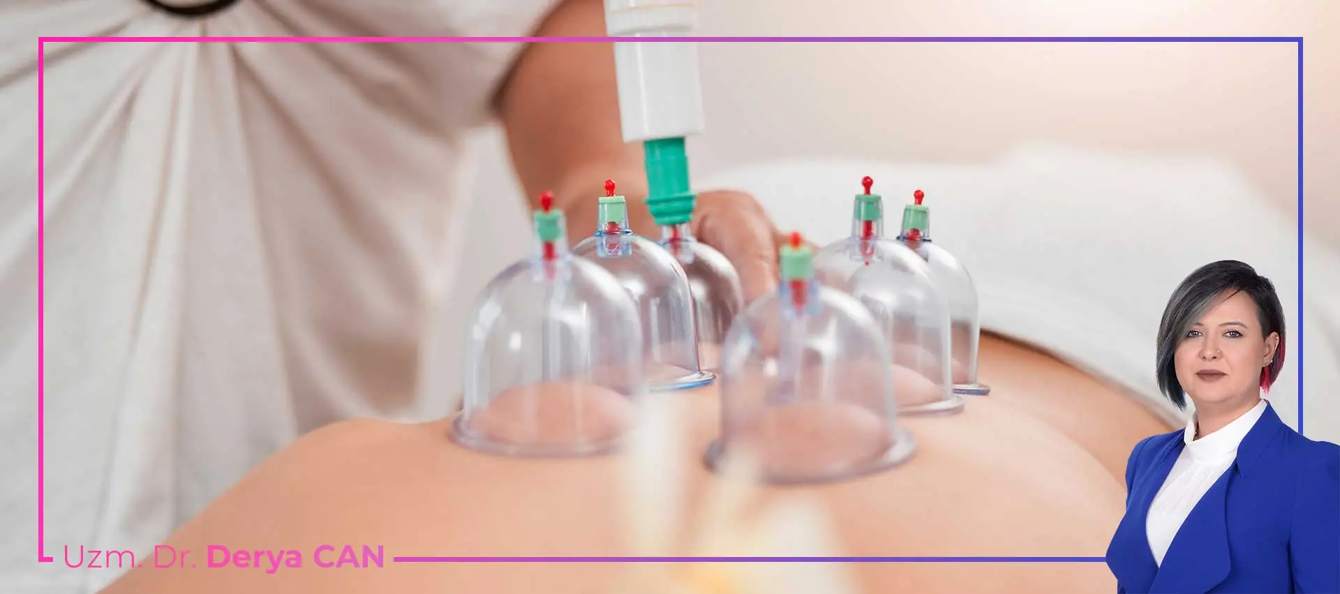 Hacamat Altın Günü Nedir? 6 Hacamat Faydaları Nelerdir? Kupa Tedavisi Nasıl Yapılır? Migren, Baş ağrısı, Altın hacamat günü nedir, Uzm Dr Derya Can