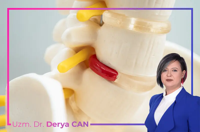Ankara’da boyun düzleşmesi belirtilerinde uzman doktor Derya Can.