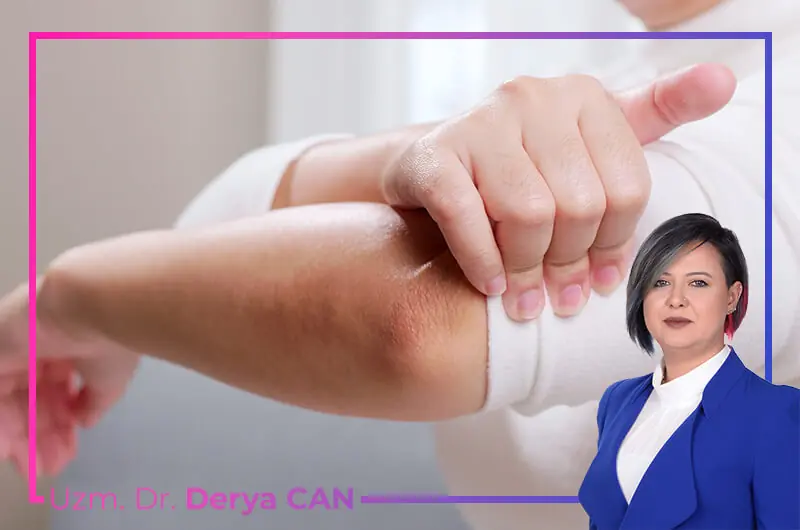 Tendinit ve Bursit sonucu oluşan eklem ağrıları görseli