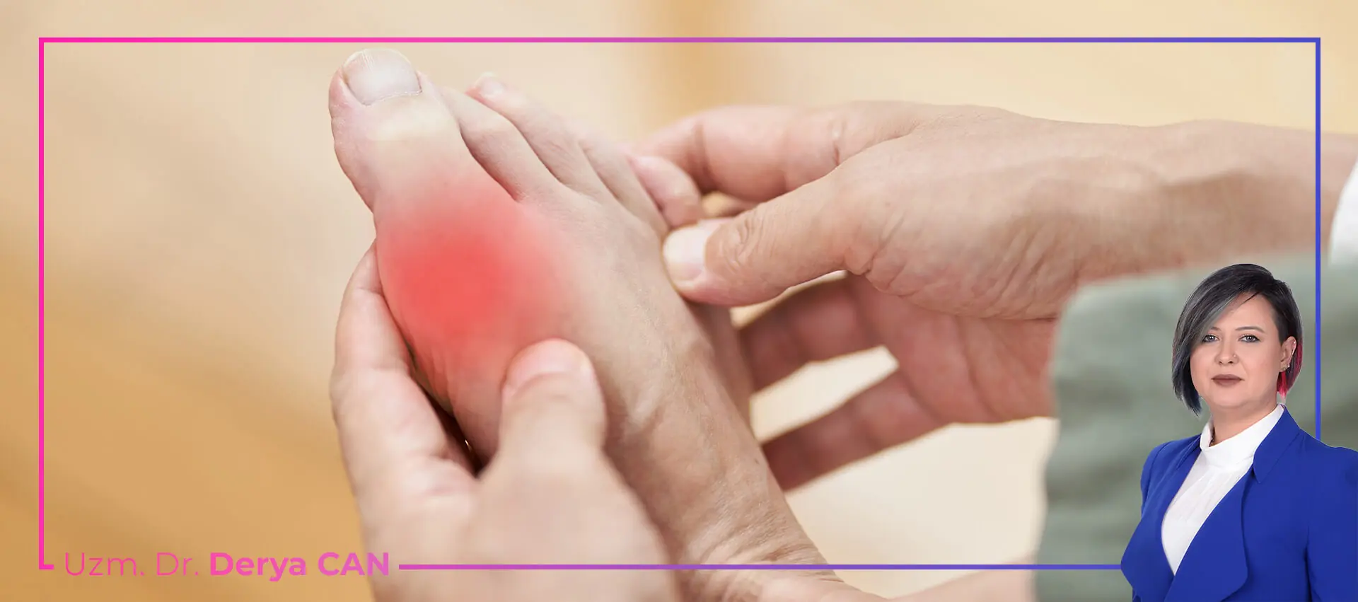 Halluks Rigidus (Sert Ayak Başparmağı) Tedavisi 2 Halluks Rigidus - Sert Ayak Baş Parmağı Belirtileri
