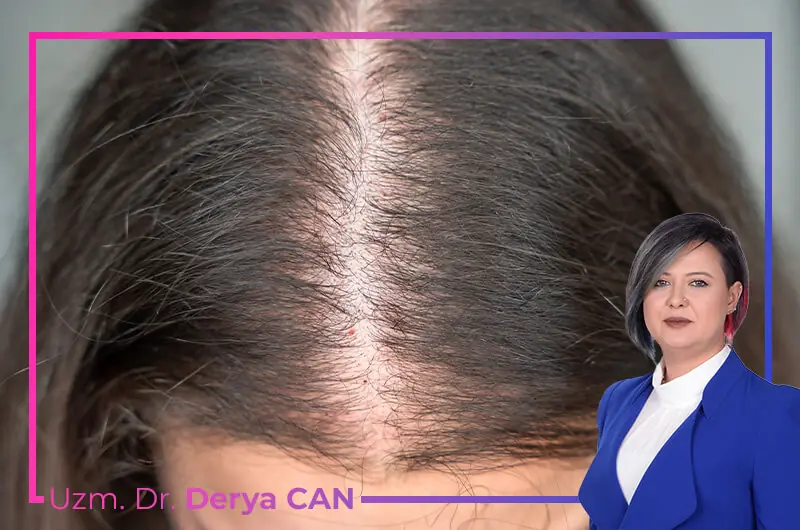 İncelen Saç Telleri Nasıl Kalınlaşır?