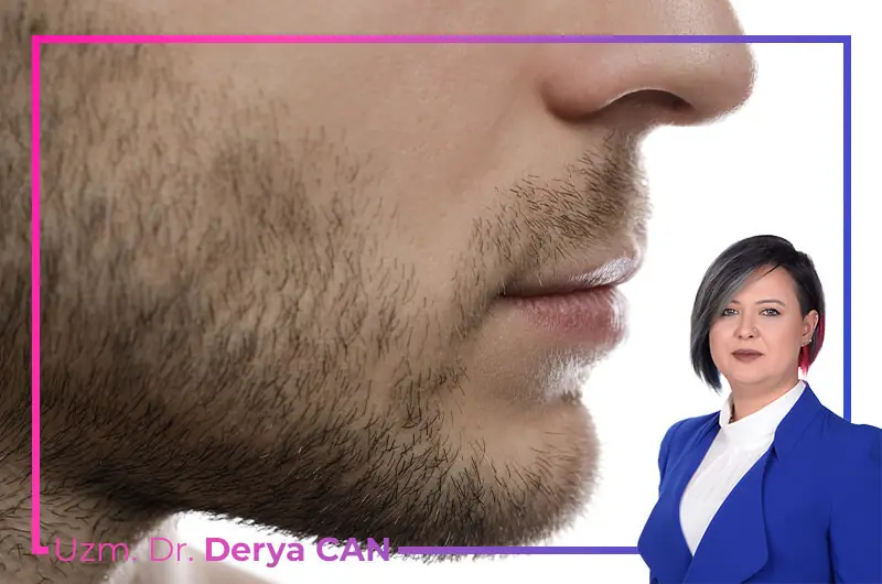 Sakal Mezoterapisi ve PRP Nedir? Aralarındaki Farklar Nelerdir?