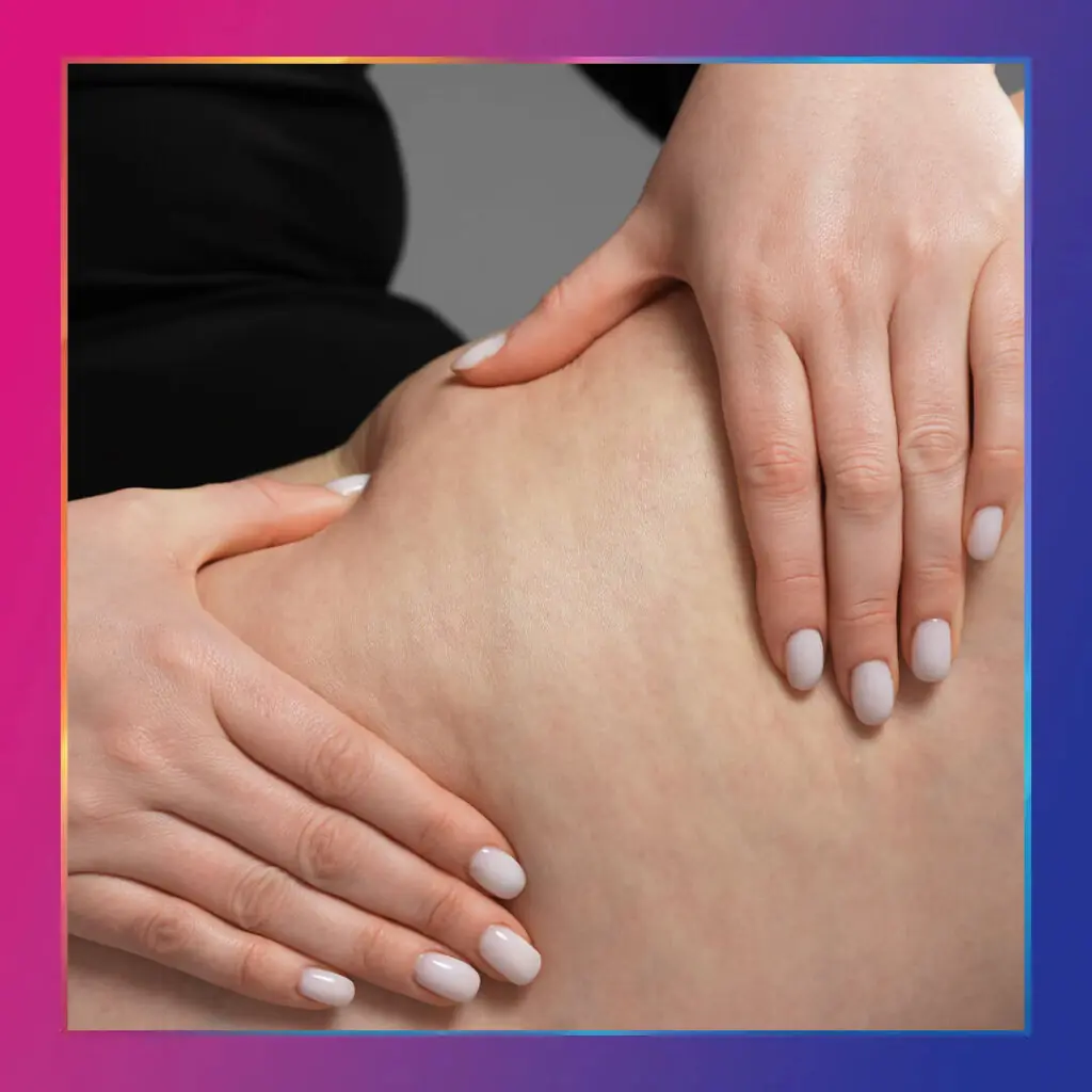 ankara selulit tedavisi cankaya