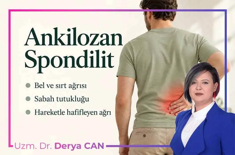 Ankilozan spondilitte bel ağrısını temsil eden, tişörtlü ve belini tutan kişi.