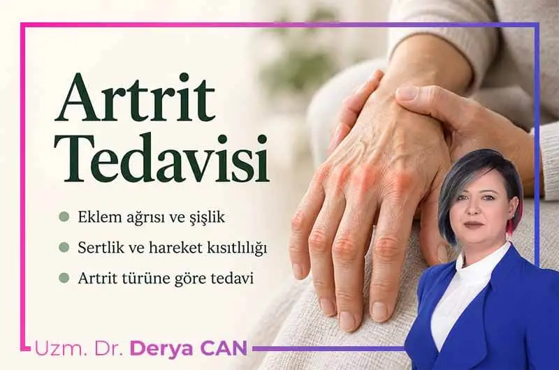 Artritte el ve parmak eklemlerindeki ağrı bölgelerinin kırmızıyla vurgulanması.
