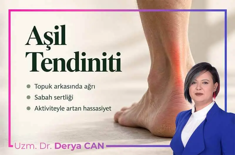 Aşil tendinitinde topuk arkasındaki ağrılı tendon bölgesinin kırmızıyla gösterimi.