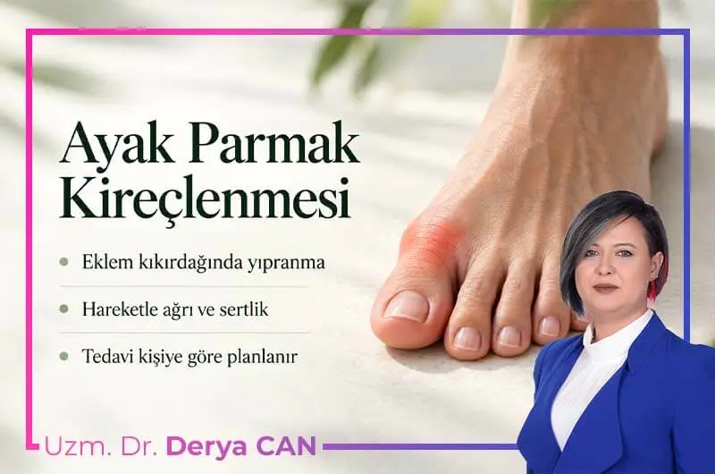 Ayak parmak kireçlenmesi belirtileri görseli